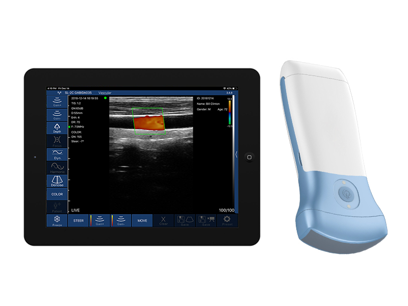 K8CPL可换电池高配三合一无线探头式掌上彩超