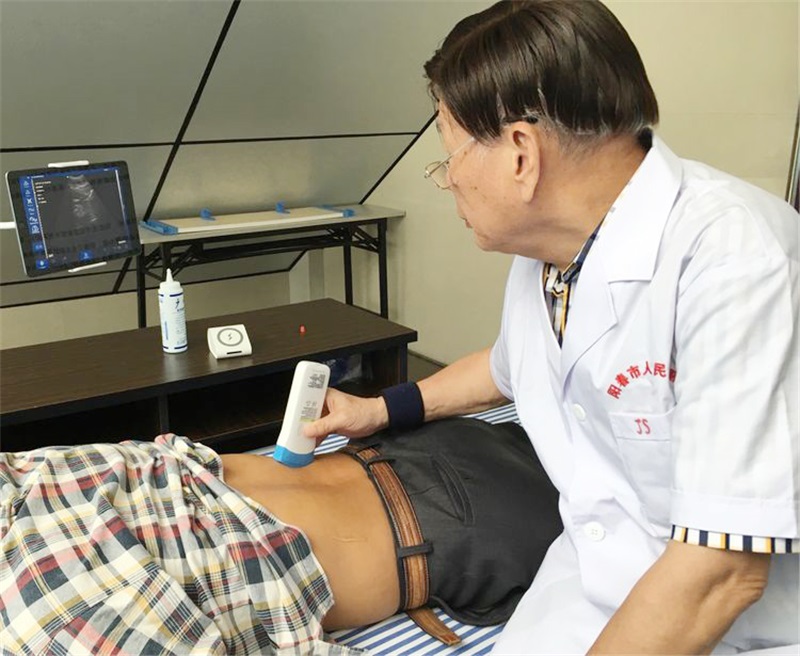 便携式超声诊断仪的两种类型:笔记本式与无线探头式的差异解析 便携式超声诊断仪的两种类型:笔记本式与无线探头式的差异解析